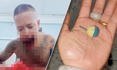 อดีตทหารใต้คุยโว โชว์ขลัง อมประทัดนัดแรกด้าน ลูก 2 ตูมคาปากเละ ลิ้นห้อย