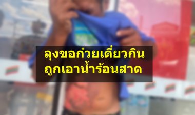 ลุงขอก๋วยเตี๋ยวทานชามหนึ่ง แต่โดนสาดน้ำร้อนไล่ ผิวหนังหลุดลอกเป็นแผลฉกรรจ์ กู้ภัยนำส่งรพ.ภูมิพล