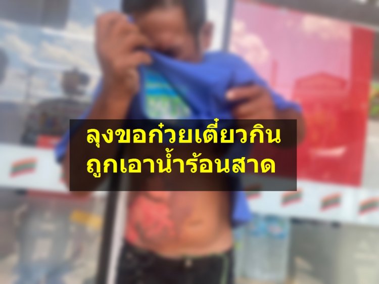 ลุงขอก๋วยเตี๋ยวทานชามหนึ่ง แต่โดนสาดน้ำร้อนไล่ ผิวหนังหลุดลอกเป็นแผลฉกรรจ์ กู้ภัยนำส่งรพ.ภูมิพล