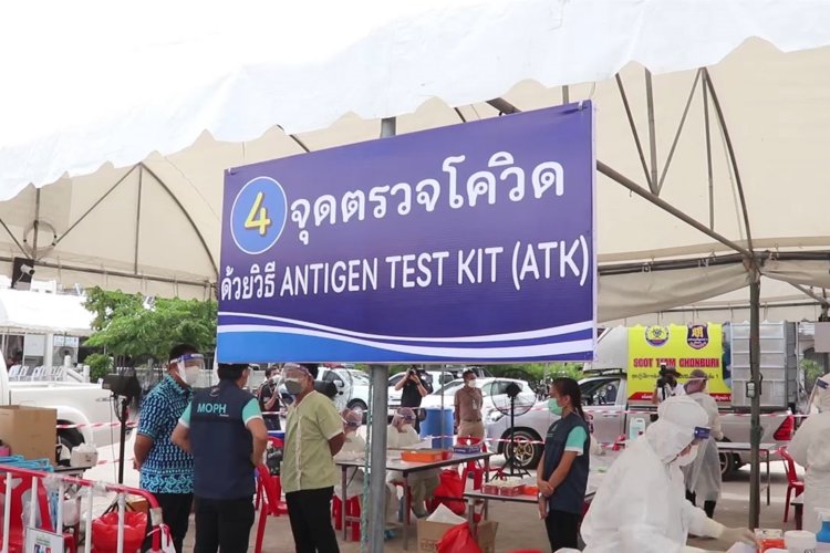 โควิดวันนี้!เสียชีวิต 84 ป่วยใหม่กว่า 9 พันราย ตรวจ ATK เข้าข่ายติดเชื้อทะลุ4พัน