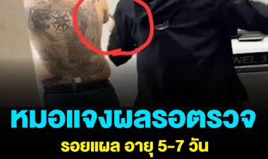 หมอแจงผลตรวจรอยแผล จ๊อบ นิทัศน์ อายุ 5-7 วัน ไม่เหมือนแผลต่อสู้