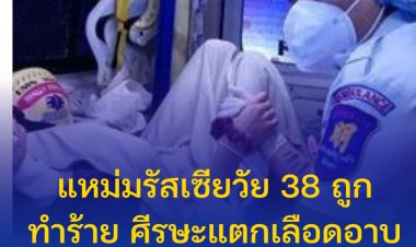 แหม่มรัสเซียวัย 38 ถูกทำร้าย ศีรษะแตกเลือดอาบ ร่างกายมีบาดแผล เจ้าตัวยังจำอะไรไม่ได้