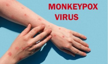 WHO ยัน ป่วยฝีดาษลิงแล้ว อย่างน้อย 2,103 คน  มีผู้เสียชีวิต 1 ราย