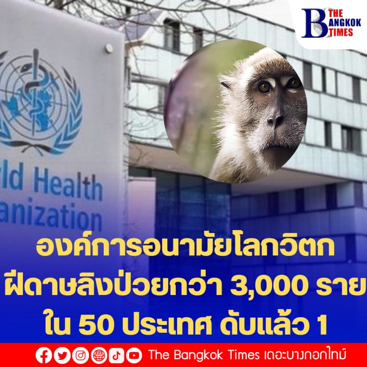 องค์การอนามัยโลกวิตก ฝีดาษลิงป่วยกว่า 3,000 ราย ใน 50 ประเทศ ดับแล้ว 1