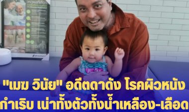 "เมฆ วินัย" อดีตดาดัง โรคผิวหนังกำเริบ เน่าทั้งตัวทั้งน้ำเหลือง-เลือด หนี้รักษาเป็นล้าน แต่ใจยังสู้  ขายสินค้าออนไลน์ไม่รับเงินบริจาค