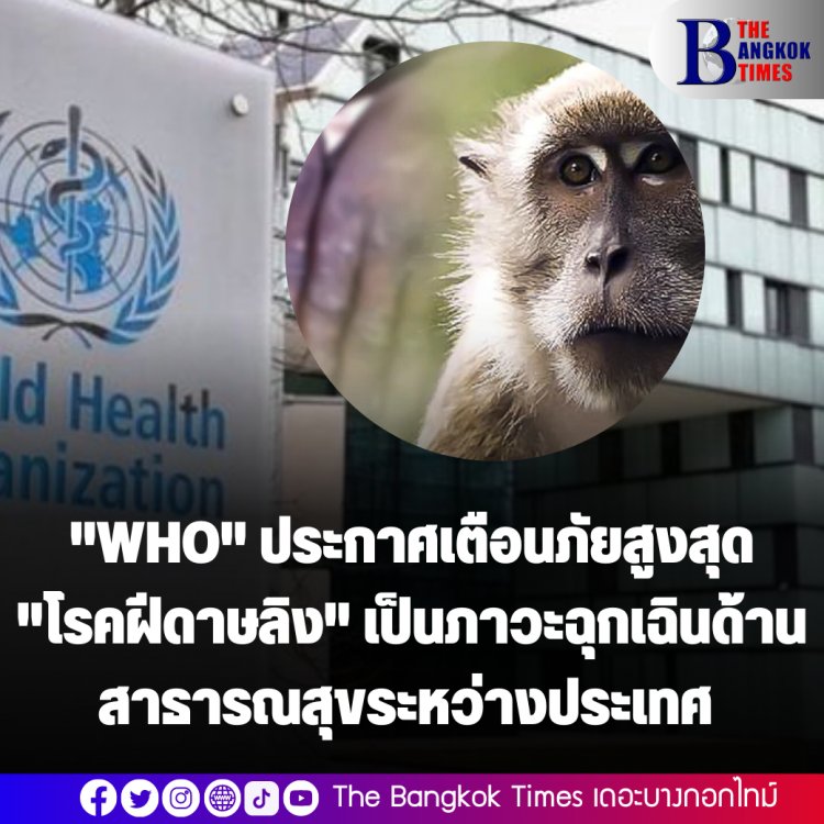 ด่วน!! "WHO" ประกาศเตือนภัยสูงสุด "โรคฝีดาษลิง" เป็นภาวะฉุกเฉินด้านสาธารณสุขระหว่างประเทศ (PHEIC)