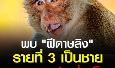 ไทยพบผู้ป่วย "ฝีดาษลิง" รายที่ 3 เป็นชายชาวเยอรมันที่ภูเก็ต