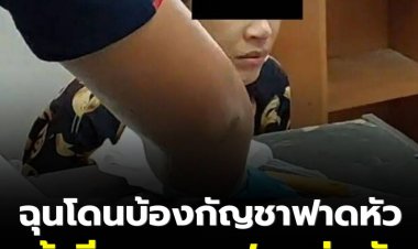 ฉุนโดนบ้องกัญชาฟาดหัว สาวสองคว้ามีดแทงแฟนหนุ่มดับ