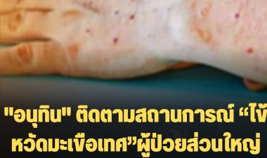 "อนุทิน" ติดตามสถานการณ์ “ไข้หวัดมะเขือเทศ” ยังแพร่ระบาดเฉพาะในต่างประเทศ ผู้ป่วยส่วนใหญ่เป็นเด็กเล็ก