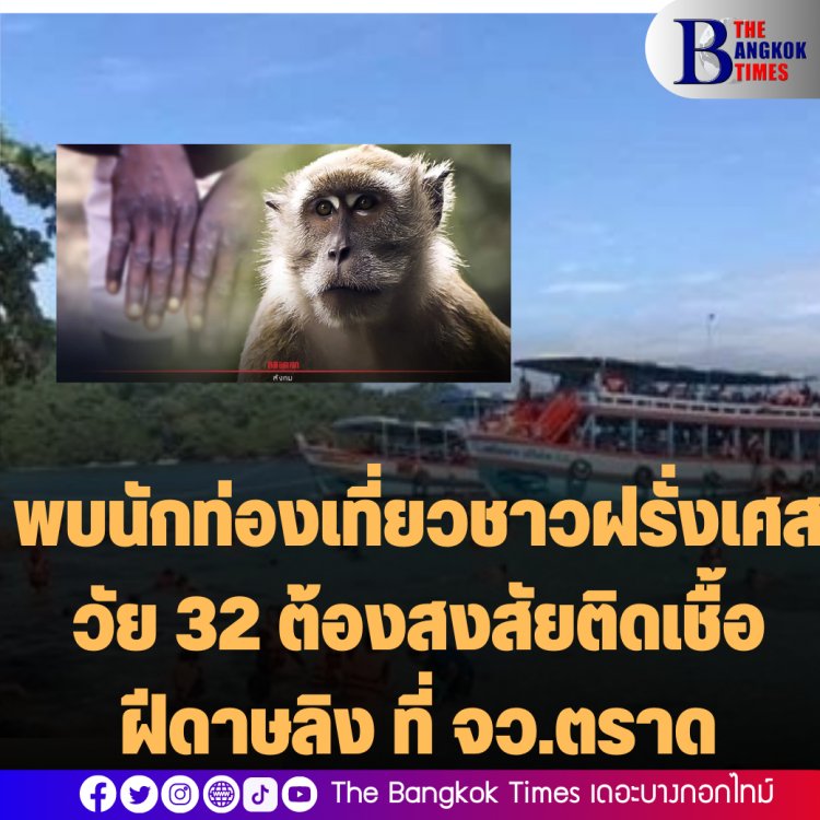 จังหวัดตราดพบนักท่องเที่ยวชาวฝรั่งเศสวัย 32 ต้องสงสัยติดเชื้อฝีดาษลิง