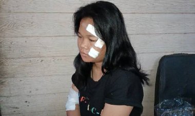 ชาวบ้านร้องทุกข์  กล้องหน้ารถบันทึกภาพนักศึกษา  ถูกรถชนได้รับบาดสาหัส แล้วหนีวอนมารับผิดชอบด้วย