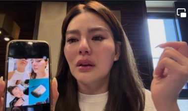 “ดิว อริสรา" โพสต์คลิปร่ำไห้ แฉ “เบนซ์ เดม่อน”อดีตแฟนเก่า ทำร้ายร่างกาย มาม่าราดหัวจนกลายเป็นแผลในใจ256
