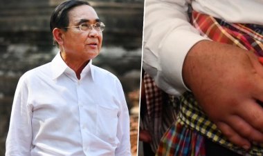 หมอ เผย  มือขวา“บิ๊กตู่”ติดเชื้อ ไร้ภาวะแทรกซ้อน ยัน ไม่ใช่เกาต์เทียม