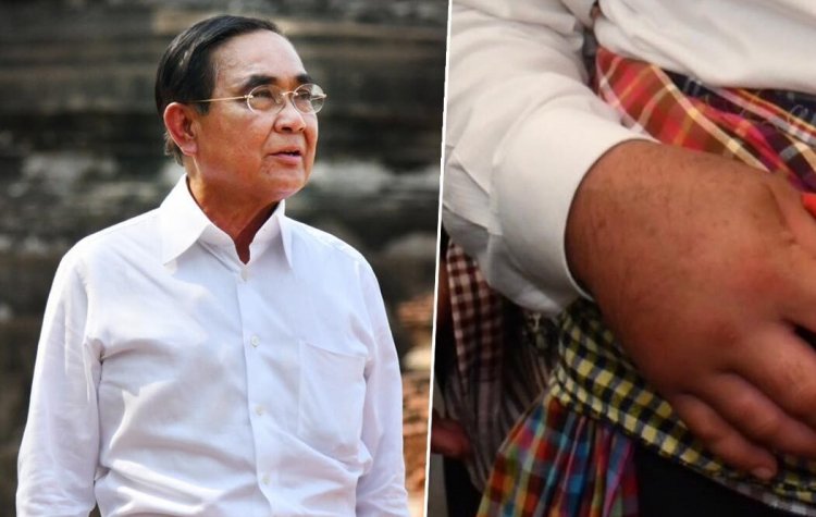 หมอ เผย มือขวา“บิ๊กตู่”ติดเชื้อ ไร้ภาวะแทรกซ้อน ยัน ไม่ใช่เกาต์เทียม