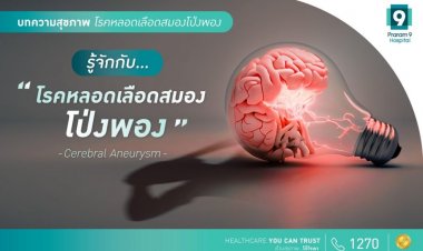แพทย์ห่วง! “หลอดเลือดสมองโป่งพอง”มรดก‘โรค’ญาติสายตรง