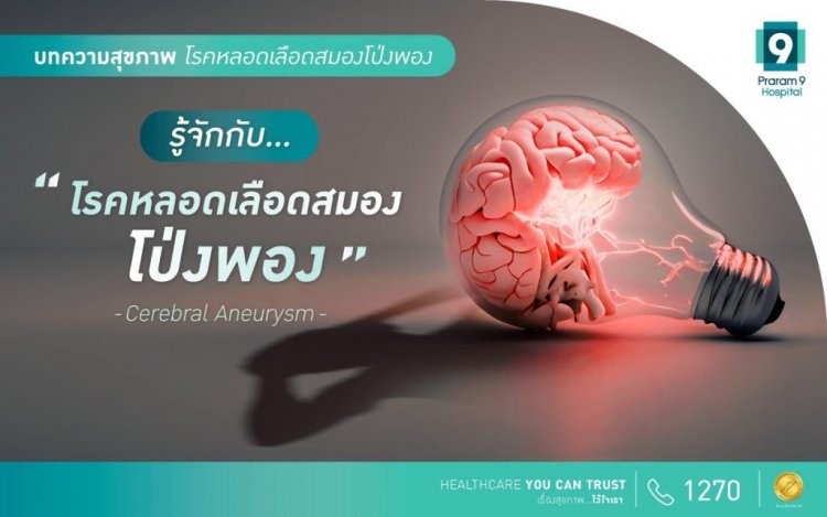 แพทย์ห่วง! “หลอดเลือดสมองโป่งพอง”มรดก‘โรค’ญาติสายตรง