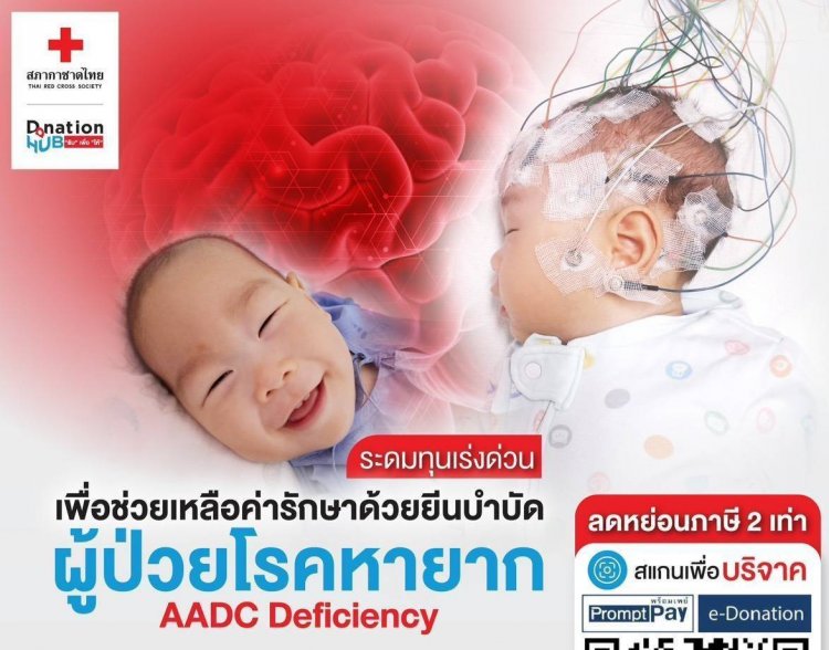 ค่ารักษา 107 ล้าน สำหรับเด็กน้อยผู้ป่วยโรคหายากหนึ่งในล้าน AADC Deficiency ความหวังที่ยังเป็นไปได้ผ่านการรักษายีนบำบัด