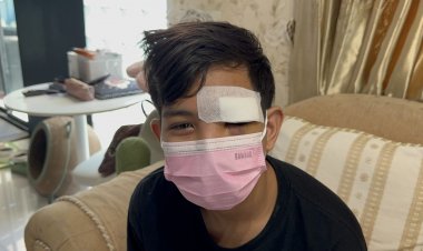 แม่ร้องสื่อ ลูกถูกโจ๋สวมหมวกดักใช้สนับมือต่อย เบ้าตา หวิดตาบอด สงสัยเพื่อนที่รร.ใหม่