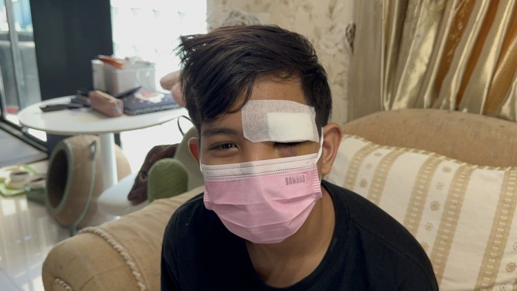 แม่ร้องสื่อ ลูกถูกโจ๋สวมหมวกดักใช้สนับมือต่อย เบ้าตา หวิดตาบอด สงสัยเพื่อนที่รร.ใหม่