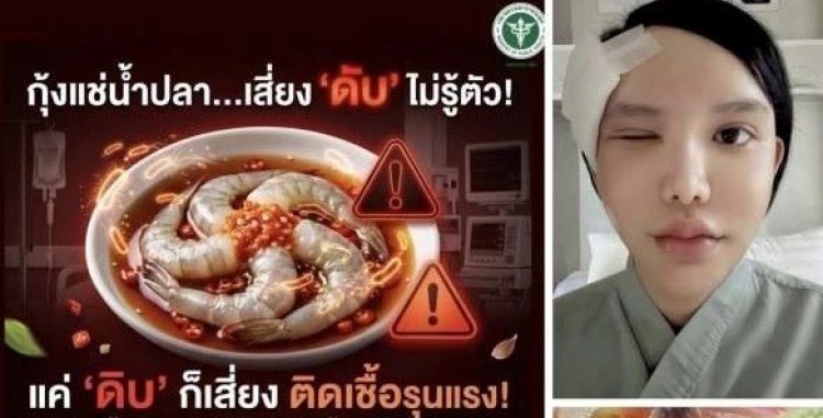 อุทาหรณ์สายดิบแซ่บ! กิน "กุ้งแช่น้ำปลา"พยาธิไชลามขึ้นตา หวิดตาบอด