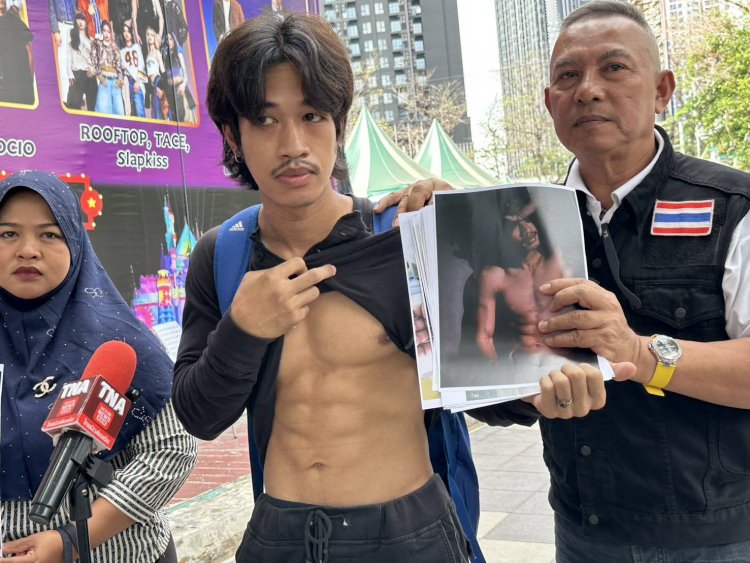 นายแบบอิสระร้อกองปราบฯคดีรถแท็กตัดหน้ากรามหนักล่าช้ามานาน 8 เดือน